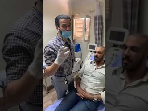 بث مباشر مع د. أحمد مكاوى بعد أسبوع من عملية زراعة الشعر