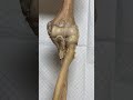 Elbow Joint