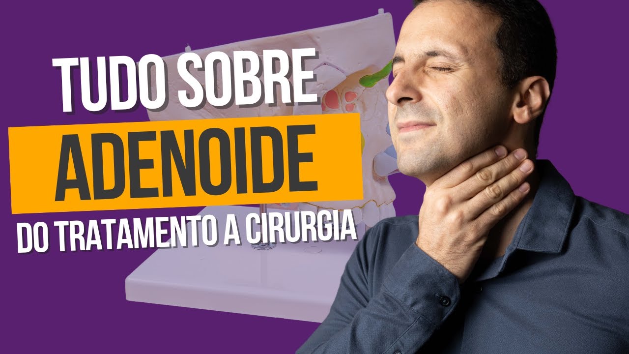 TUDO SOBRE ADENOIDE, DO TRATAMENTO À CIRURGIA