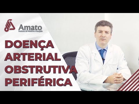 Doença Arterial Obstrutiva Periférica