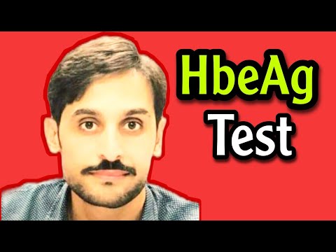 HbeAg Test | Hepatitis B Envelope Antigen