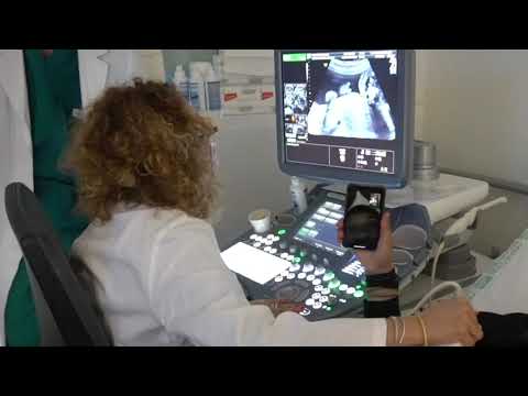 Ultrasound at 5 Months Pregnant | Sonogram in Italy