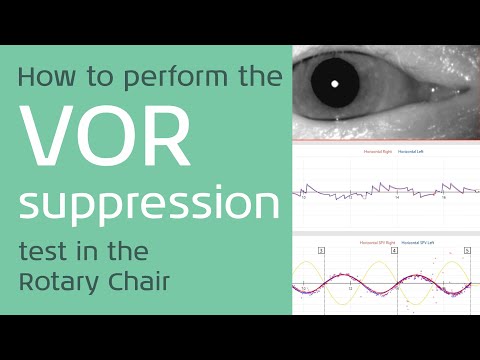 How to perform the VOR Suppression Test on the Rotary Chair