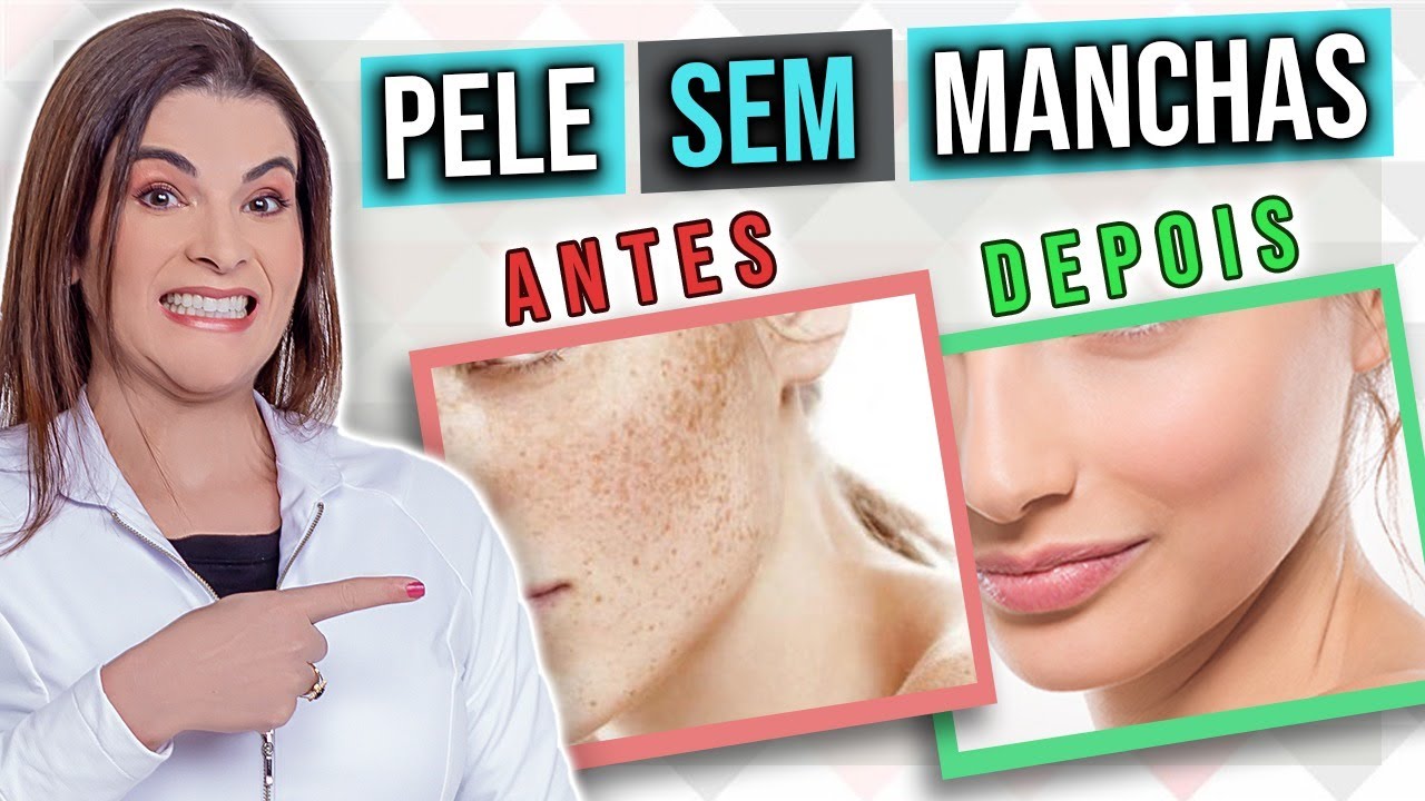 5 Melhores ÁCIDOS que Você Deve Usar Para Clarear Manchas na Pele