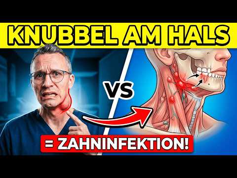Dicke Backe + Knubbel am Hals? DAS musst du SOFORT tun! 🚨