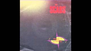 1991 SCABS don&#39;t you know