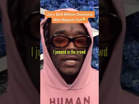 Lil Uzi Vert Got Rid Of The 24 Million Diamond On His Forehead