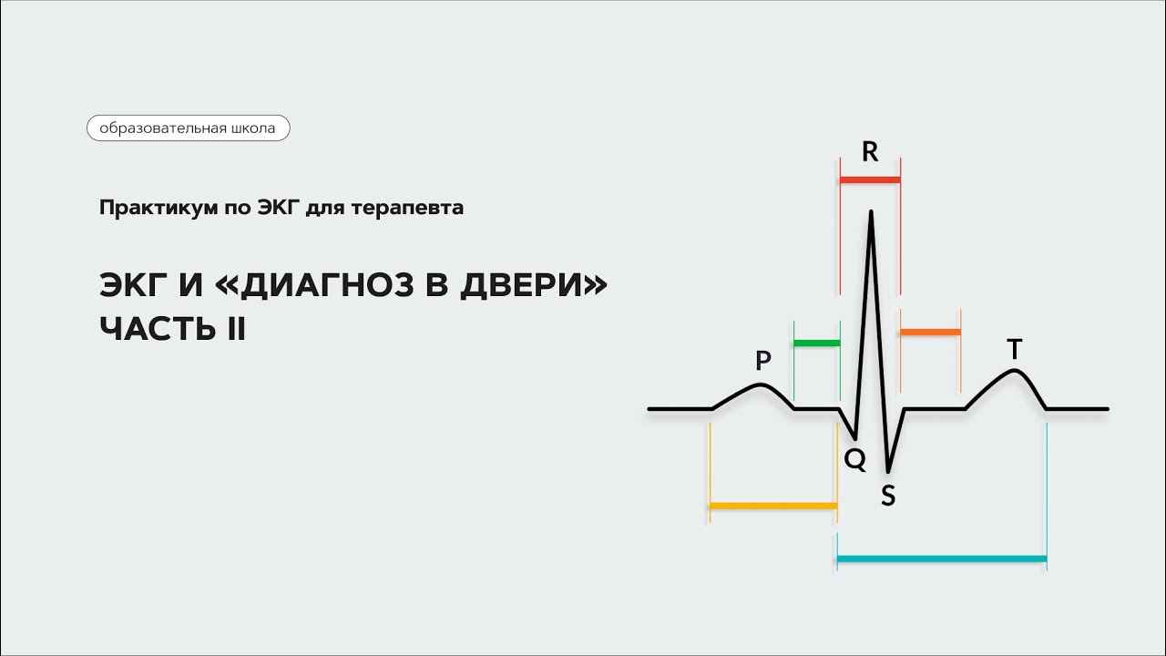ЭКГ и «Диагноз в двери». Часть II