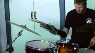Un brazo prostético permite a un músico seguir tocando la batería