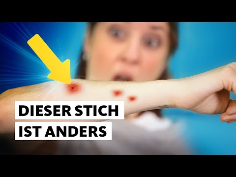 Die Tigermücke: Was du tun musst, wenn du sie siehst | Studio Q