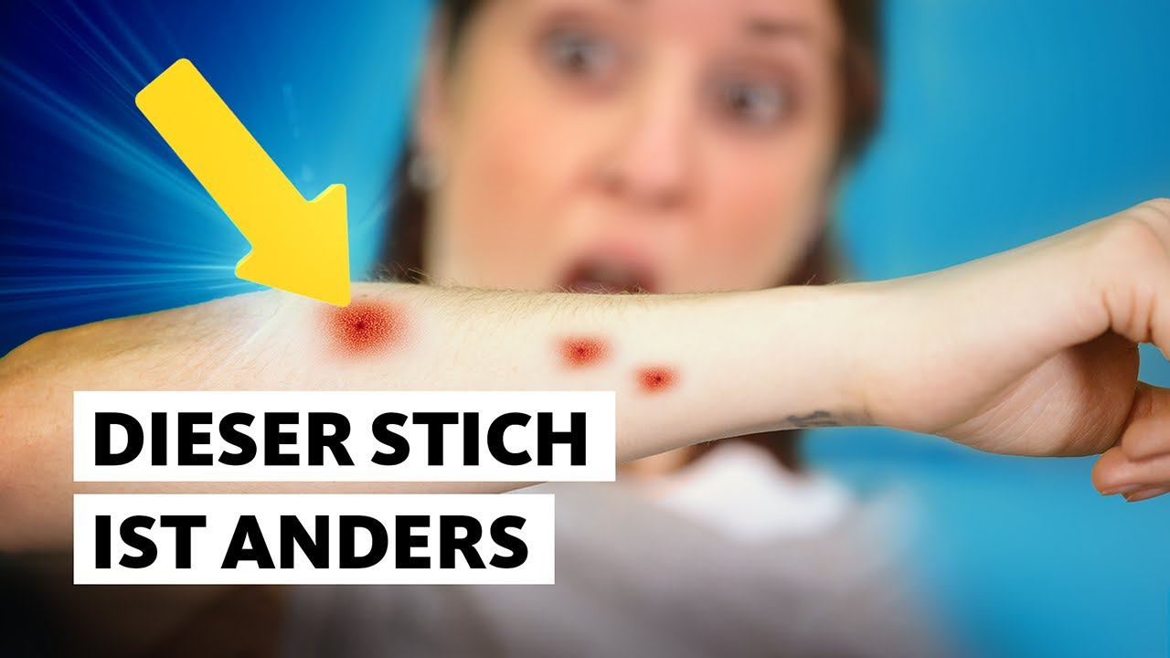 Die Tigermücke: Was du tun musst, wenn du sie siehst | Studio Q