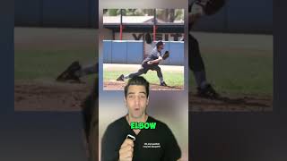Baseball Shoulder and Elbow Risk