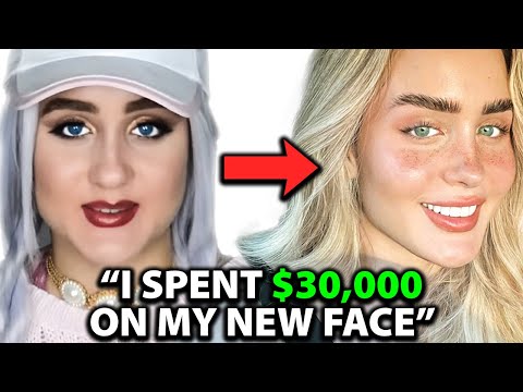 I was UGLY Before Spending $30,000 on a NEW FACE | Surgeon Reacts