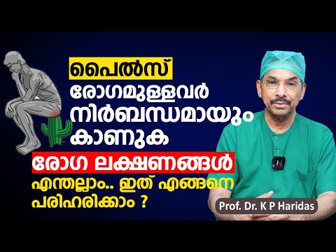 പൈൽസ് രോഗമുള്ളവർ നിർബന്ധമായും കാണുക | Piles Treatment Malayalam | Dr  K P Haridas