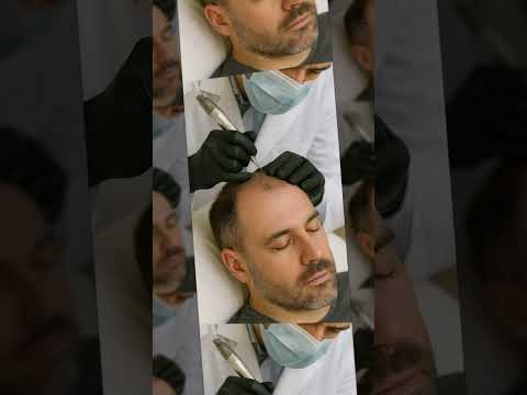 Cassyo Tornesi-18