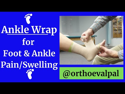 Metatarsalgia and Morton s Neuroma Evaluation and Treatment