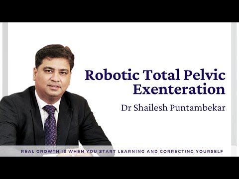 Pelvic Exenteration Surgery for Advanced Cervical Cancer
