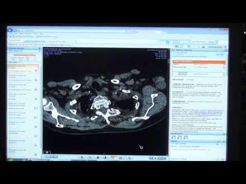 [Demo] Latest Version of Vue Motion--Zero-Footprint Viewer