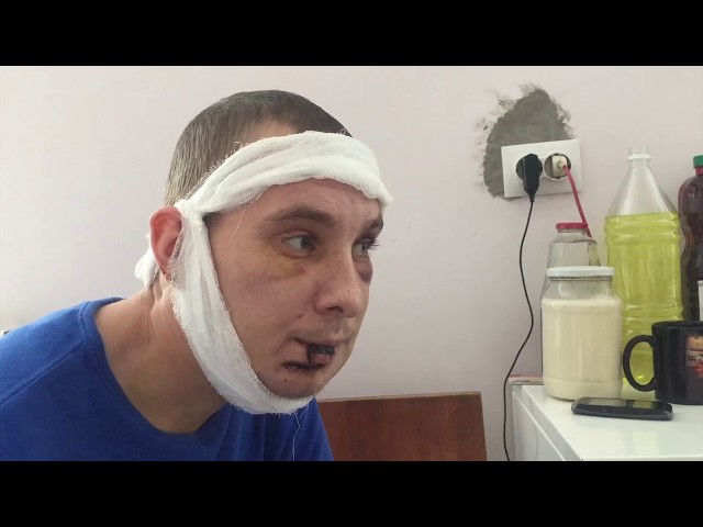 После встречи с полицией ангарчанин угодил в больницу