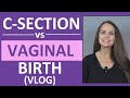 C Section Vs Vaginal Birth Delivery My Experience Birth Vlog