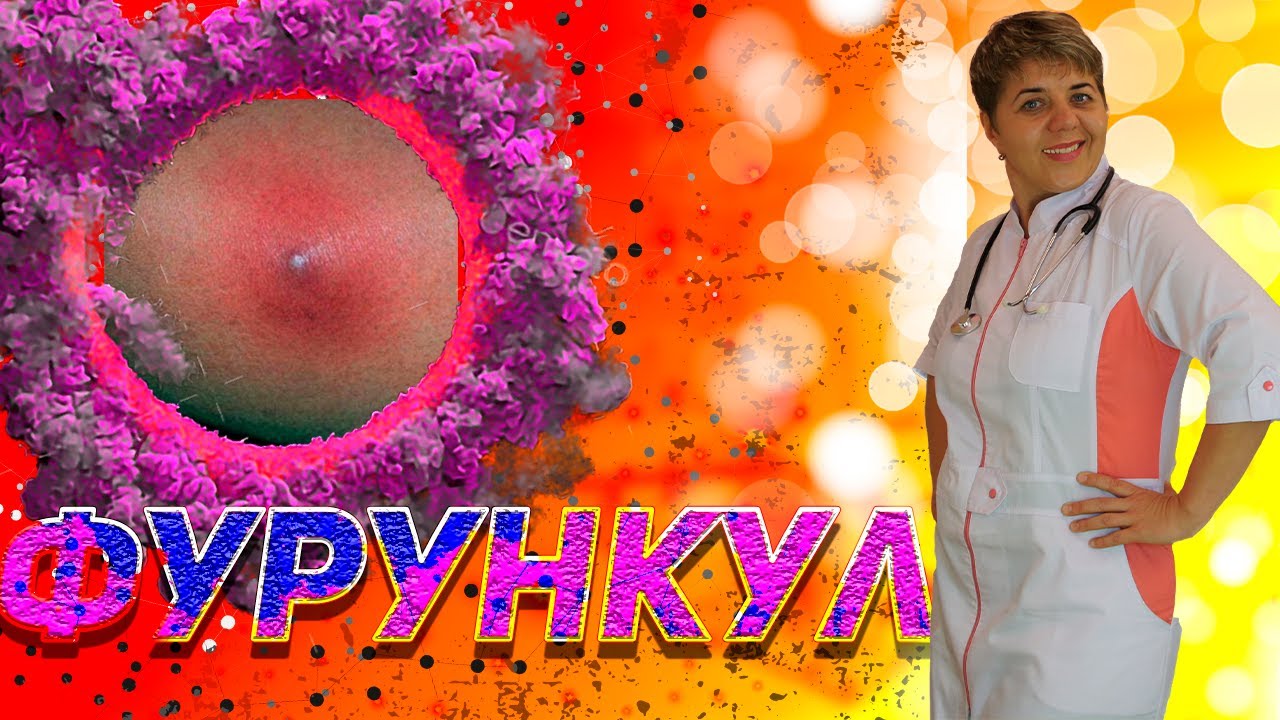 💊 ФУРУНКУЛ 🔴 Как лечить фурункулы в домашних условиях (чирий)  МЕДИЦИНА ЗДОРОВЬЕ Разумная медицина