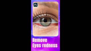 How to remove eyes redness in Photoshop #shorts #photoshoptutorial #photoediting