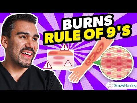 Burns Nursing Overview | Rule of Nines, Types, Causes, Care