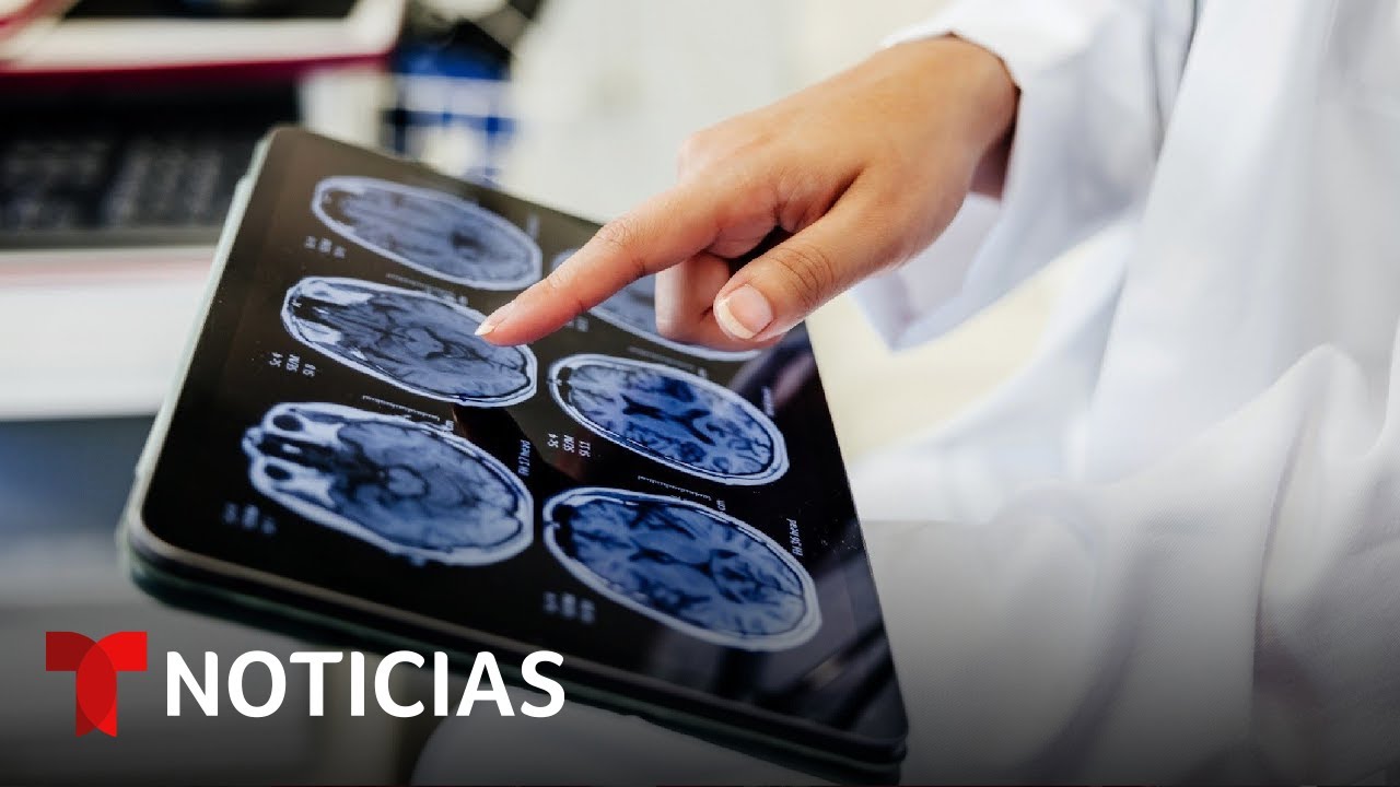 Mantener la mente activa nos ayuda a combatir los riesgos de demencia