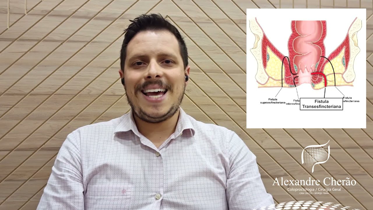 Alexandre Andrade Da Silva Cherão-11