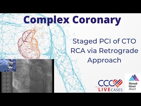 Staged PCI of CTO RCA via Retrograde Approach - CCC Live Cases June 16, 2015 Webcast