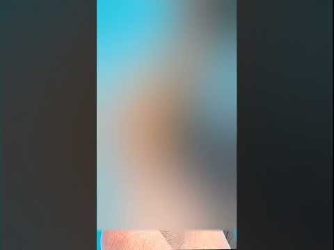 Stabbed With A Pencil: ER Or Not? 🤔