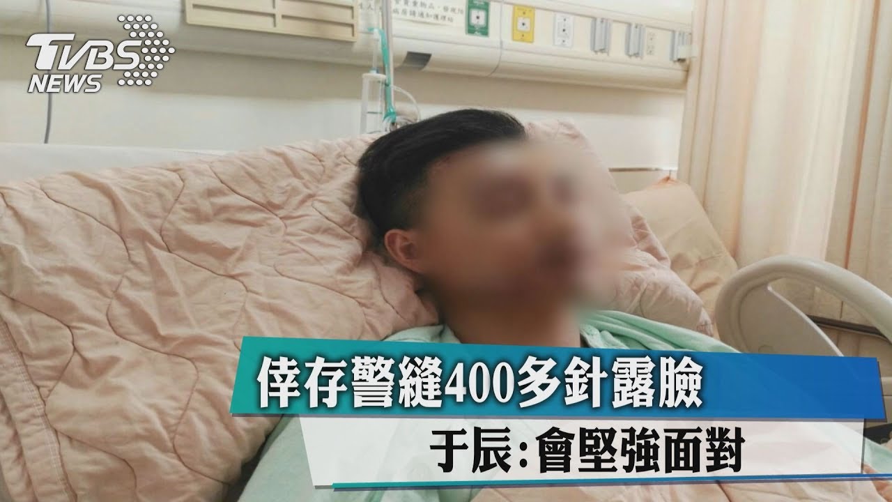 縫400針!得知學長殉職 國道車禍倖存警:我會堅強