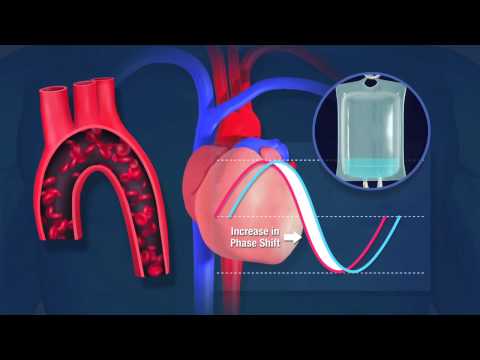 Introduction to the CHEETAH NICOM for Hemodynamic Monitoring