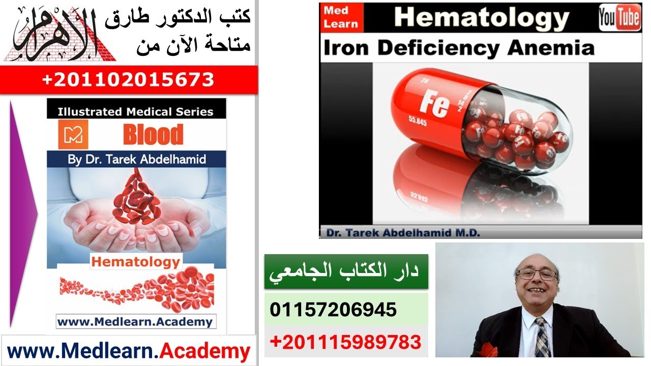 Iron Deficiency Anemia   #cme #internal_medicine #medical #usmle #محاضرات_باطنة