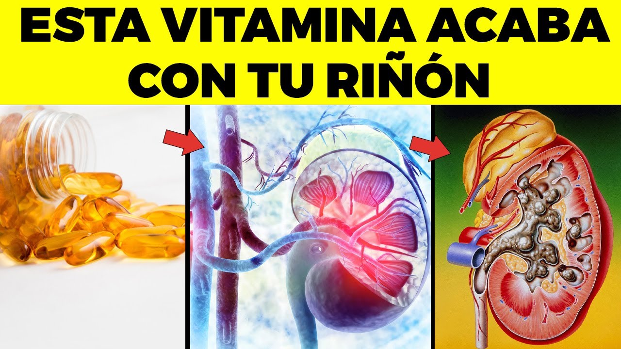 Watch 9 vitaminas y suplementos por los que tienes DAÑO en tu hígado y riñón Now 9 vitaminas y suplementos por los que tienes DAÑO en tu hígado y riñón