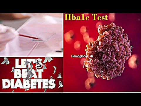 Hba1c - Normal Range | Test for Diabetes Screening