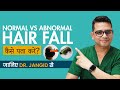 Normal Vs Abnormal Hair Fall Differences Treatments Hair Fall Vs Severe Hair Loss Shedding