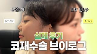 EDITION TV - 직장인의 현실 코재수술 브이로그 | 예쁜데 더 예뻐진 그녀의 붓기 관리 꿀팁