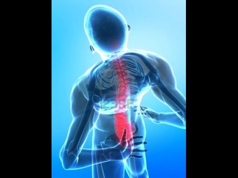 Лечение отека нервных корешков позвоночника При цистите спина болит
