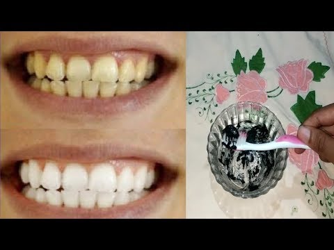 download lagu mp3 mp4 Cara Mendapatkan Gigi Putih Secara Alami, download lagu Cara Mendapatkan Gigi Putih Secara Alami gratis, unduh video klip Cara Mendapatkan Gigi Putih Secara Alami