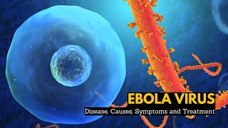 Ebola Virus Disease, Causes, Signs and Symptoms, Diagnosis and Treatment.