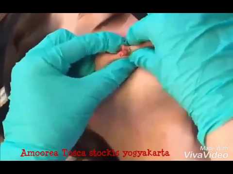 Hitam kontol besar di pantat putih kecil Bagaimana mengambil apa impotensi castoreum