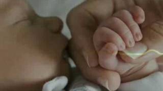 Determining if Your Child’s Cerebral Palsy Was Caused by Medical Negligence video thumbnail