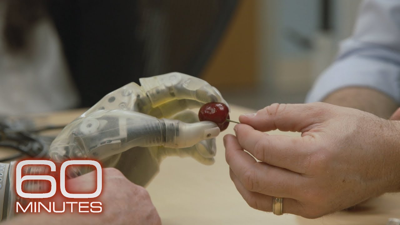 Following the breakthroughs in prosthetics | 60 Minutes