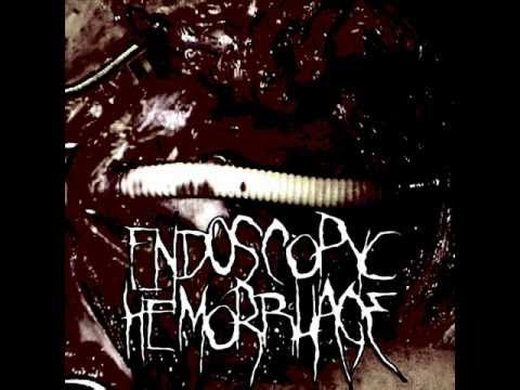 Endoscopyc Hemorrhage - Endoscopyc Hemorrhage (alternate version)