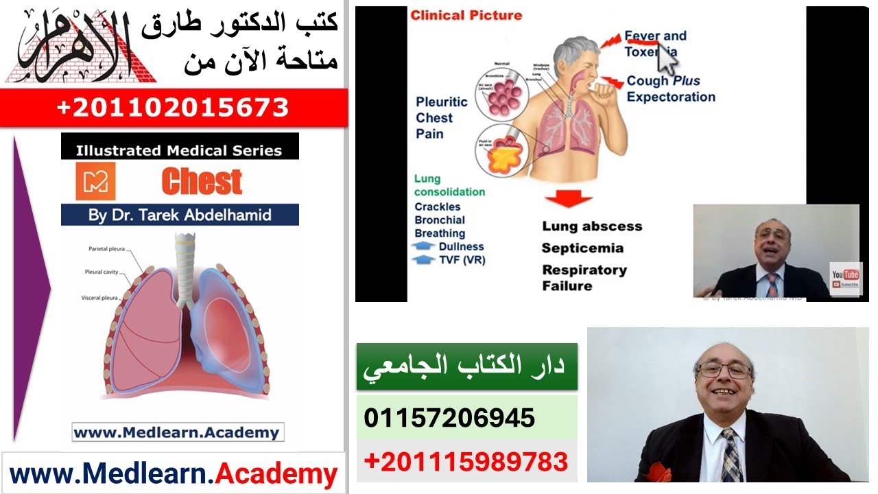 Pneumonia (I)  #cme #internal_medicine #medical #usmle #محاضرات_باطنة
