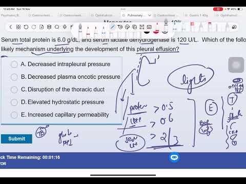UWorld Concept: Pleural Effusion – Light’s Criteria Cheat Code