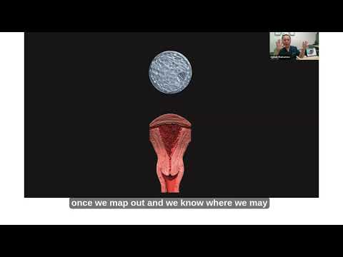 🎥 An Hour with QENDO: Let’s Talk IVF: Understanding the Journey