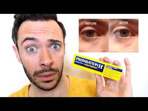 HOW TO GET RID of UNDER EYE BAGS & DARK CIRCLES INSTANTLY w/ PREPARATION H | Does It Really Work? Video