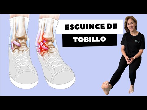 ESGUINCE DE TOBILLO